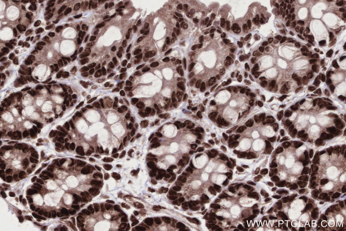 Immunohistochemical analysis of paraffin-embedded rat colon tissue slide using KHC2673 (STAG2 IHC Kit).
