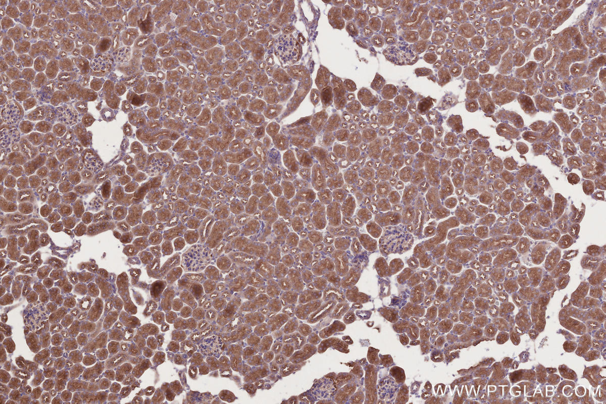 Immunohistochemical analysis of paraffin-embedded mouse kidney tissue slide using KHC2754 (STAM IHC Kit).