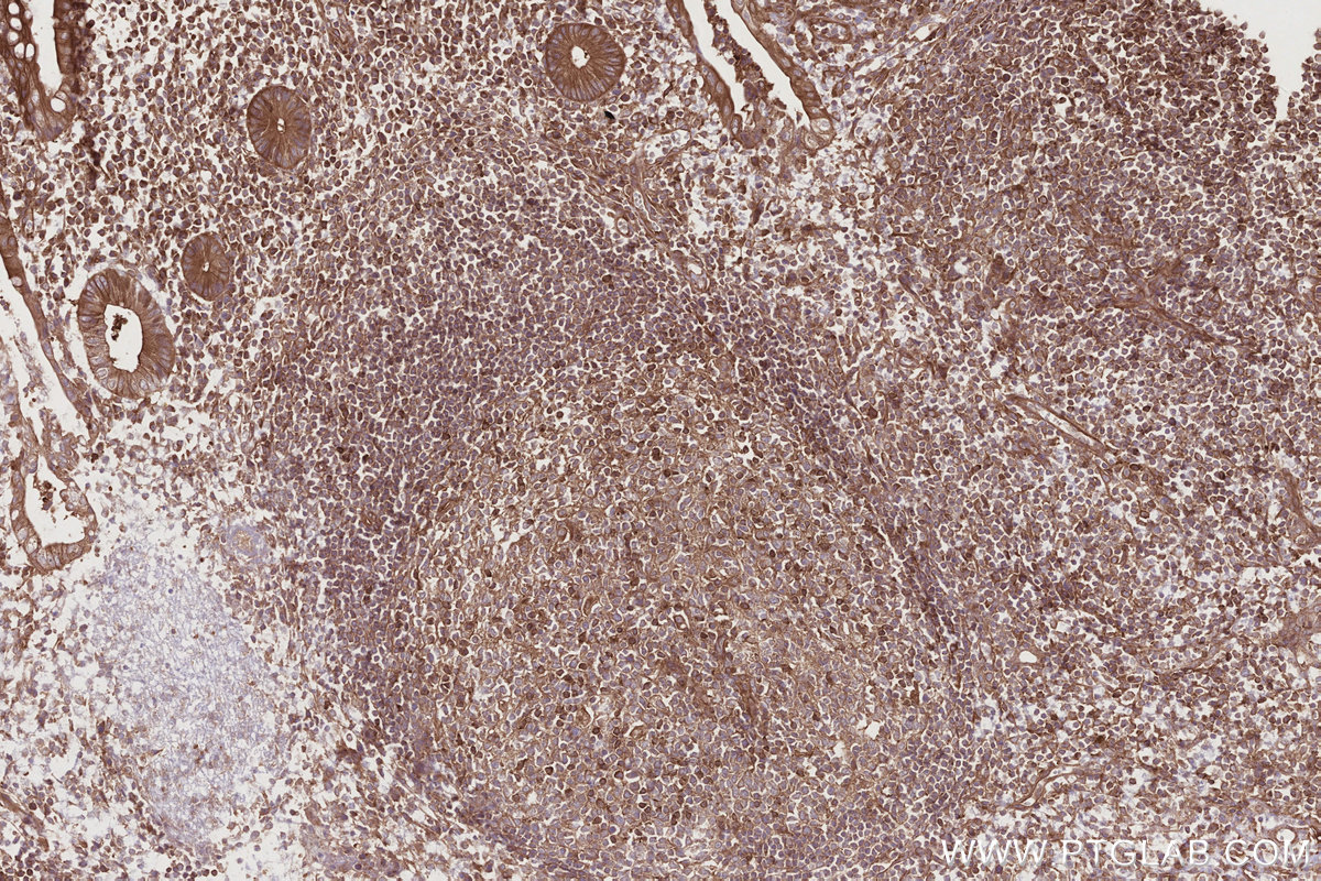 Immunohistochemical analysis of paraffin-embedded human appendicitis tissue slide using KHC2754 (STAM IHC Kit).