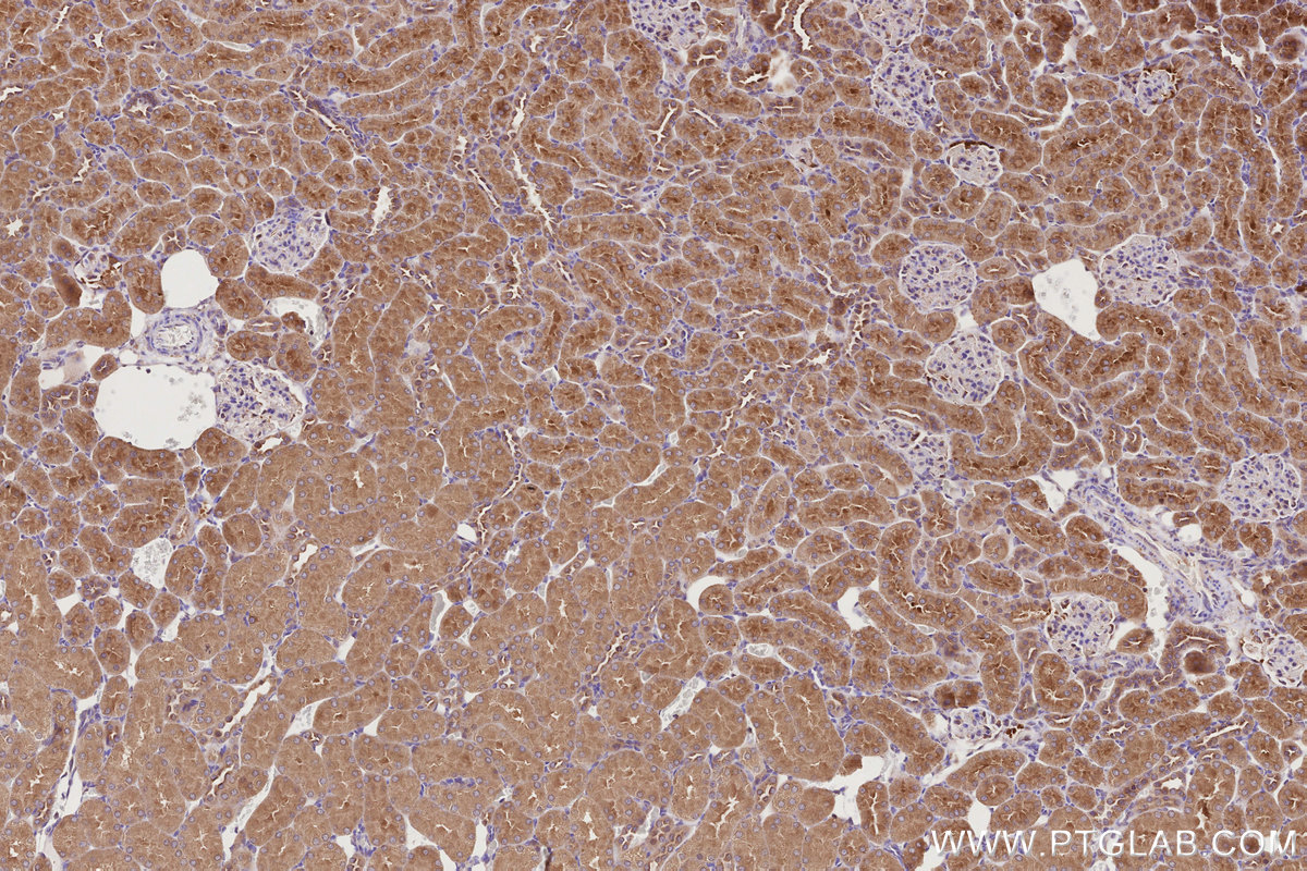 Immunohistochemical analysis of paraffin-embedded rat kidney tissue slide using KHC2754 (STAM IHC Kit).