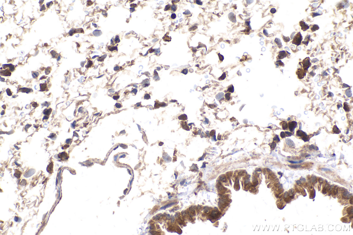 Immunohistochemical analysis of paraffin-embedded rat lung tissue slide using KHC2139 (STAM2 IHC Kit).