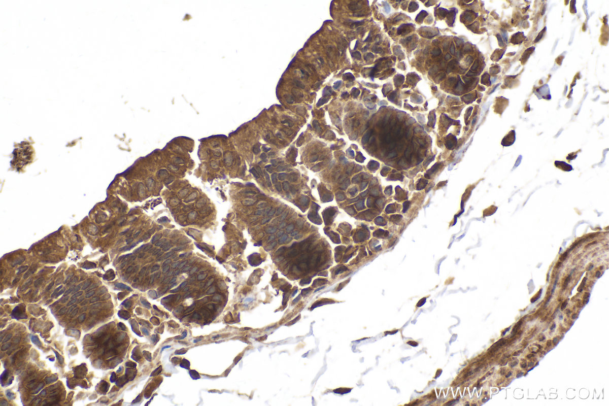 Immunohistochemical analysis of paraffin-embedded mouse intestine tissue slide using KHC2139 (STAM2 IHC Kit).