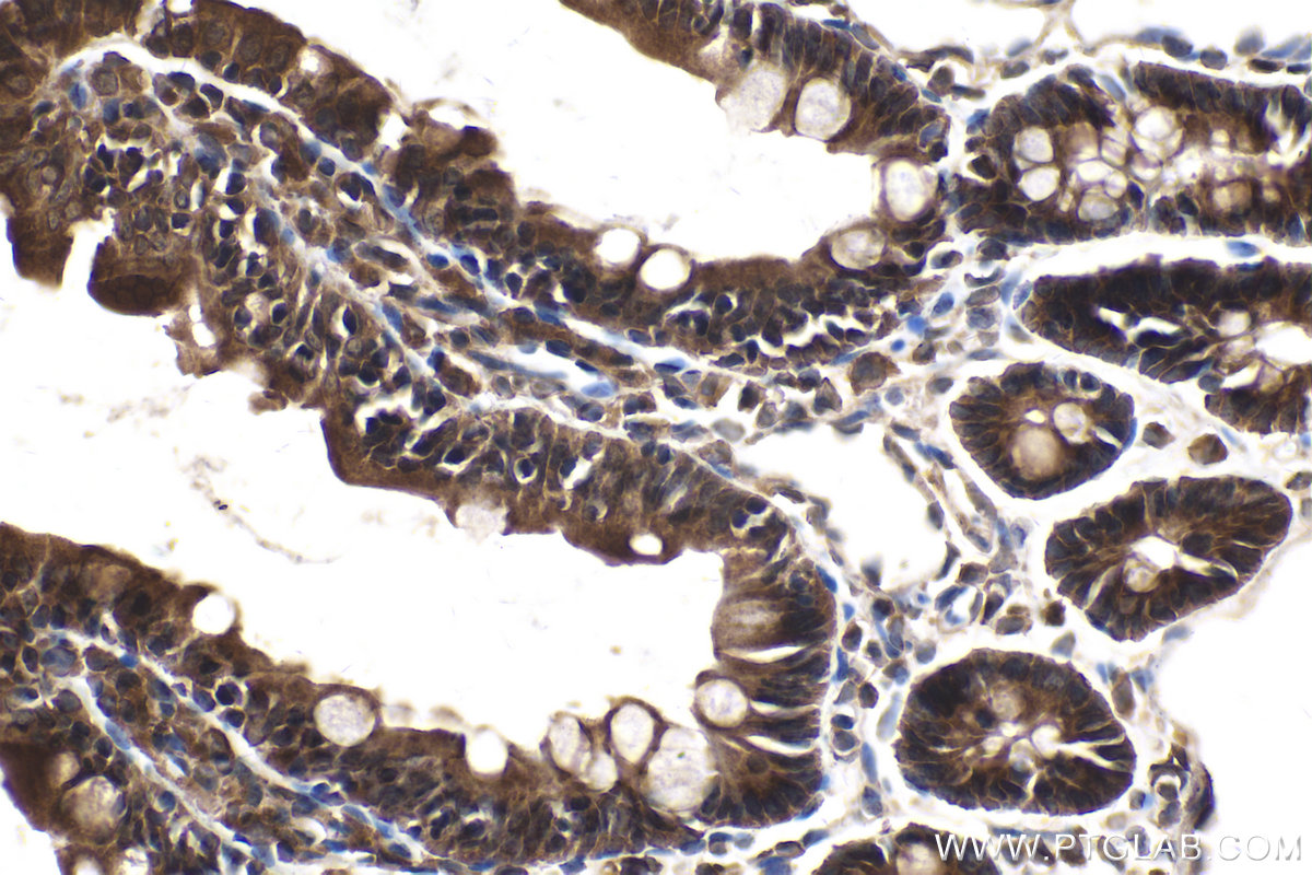 Immunohistochemical analysis of paraffin-embedded rat small intestine tissue slide using KHC2139 (STAM2 IHC Kit).