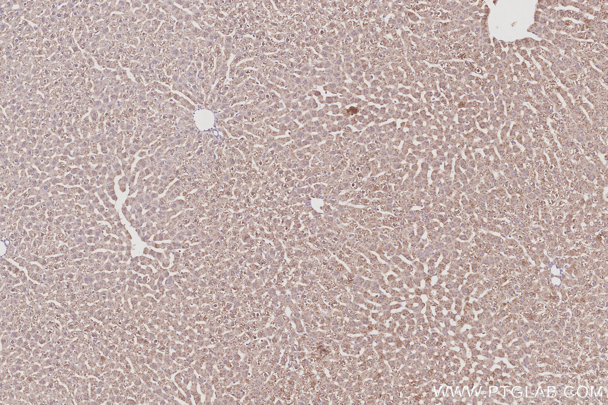 Immunohistochemical analysis of paraffin-embedded rat liver tissue slide using KHC3065 (STARD13 IHC Kit).