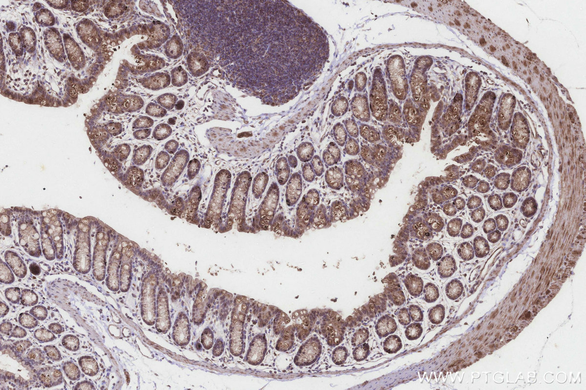 Immunohistochemical analysis of paraffin-embedded mouse colon tissue slide using KHC3253 (STARD3/MLN64 IHC Kit).
