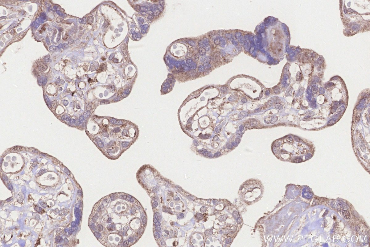 Immunohistochemical analysis of paraffin-embedded human placenta tissue slide using KHC3253 (STARD3/MLN64 IHC Kit).