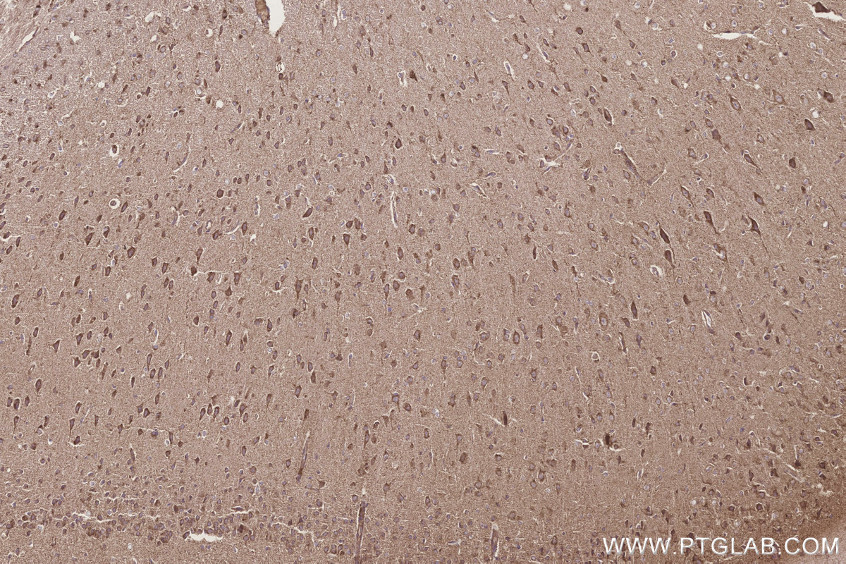 Immunohistochemical analysis of paraffin-embedded rat brain tissue slide using KHC3253 (STARD3/MLN64 IHC Kit).