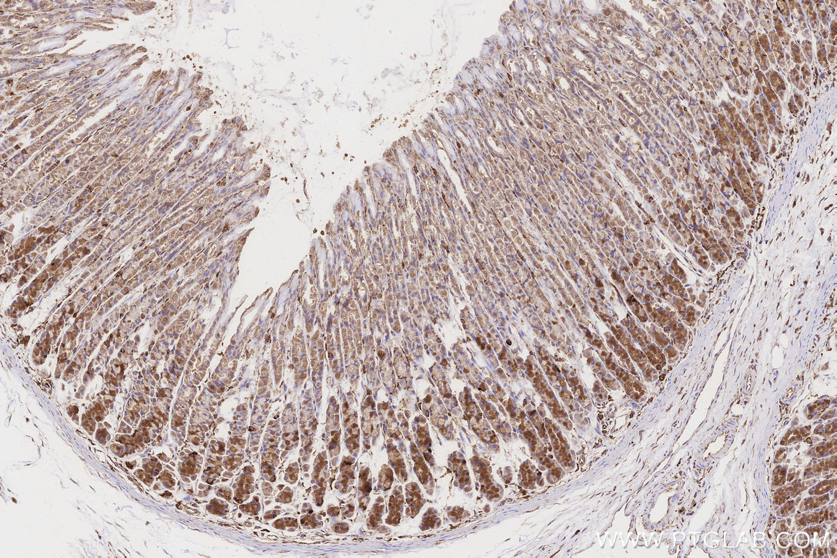 Immunohistochemical analysis of paraffin-embedded rat stomach tissue slide using KHC3157 (STARD3NL IHC Kit).