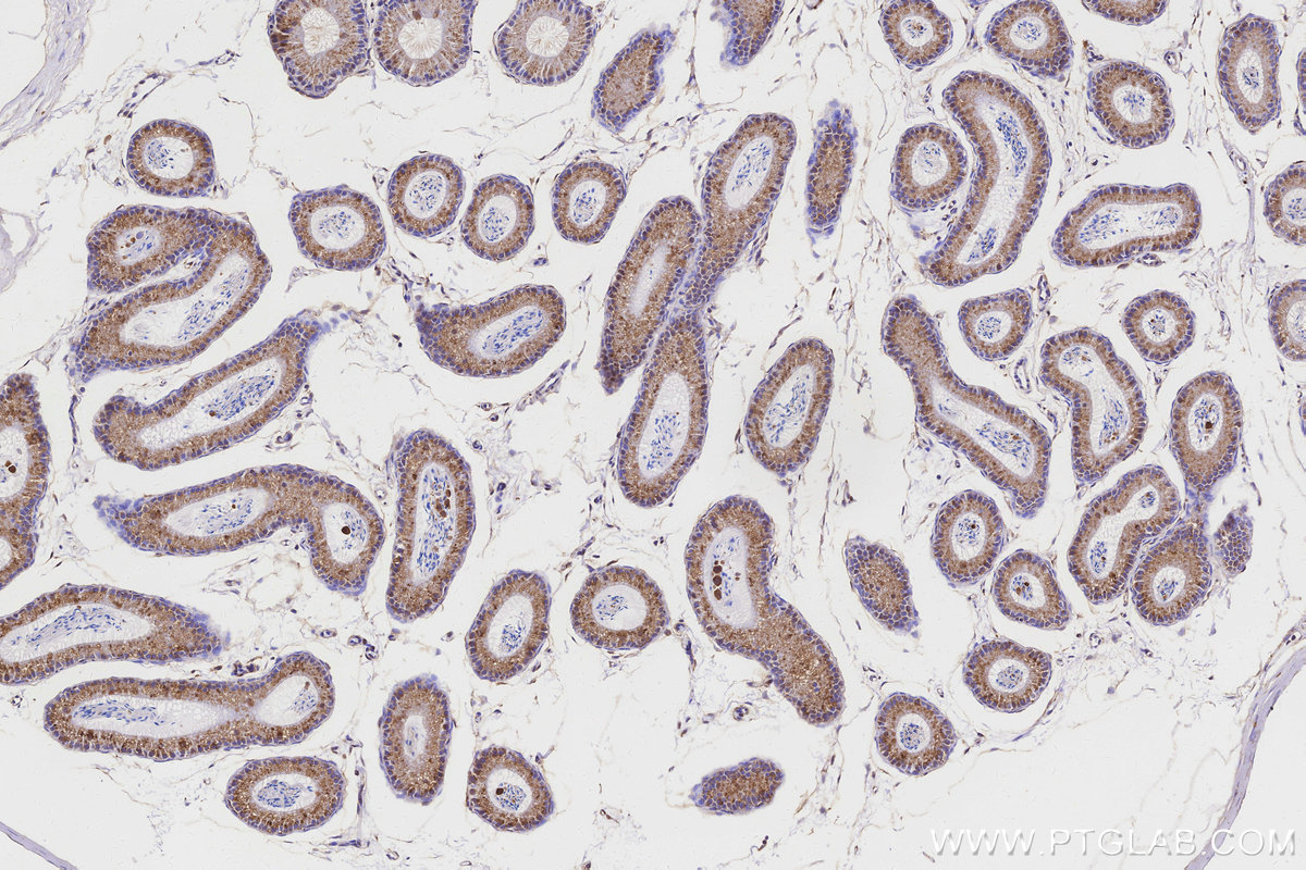 Immunohistochemical analysis of paraffin-embedded mouse epididymis tissue slide using KHC3157 (STARD3NL IHC Kit).