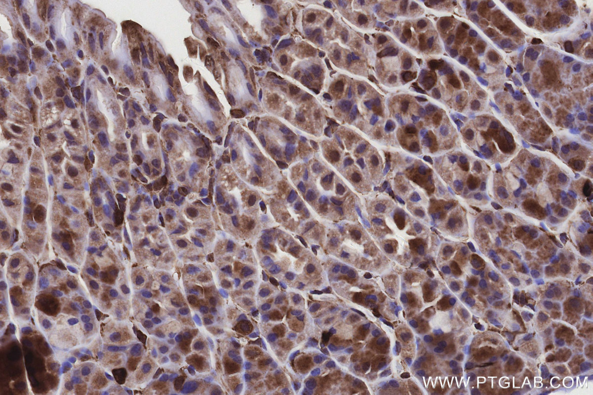 Immunohistochemical analysis of paraffin-embedded mouse stomach tissue slide using KHC3157 (STARD3NL IHC Kit).