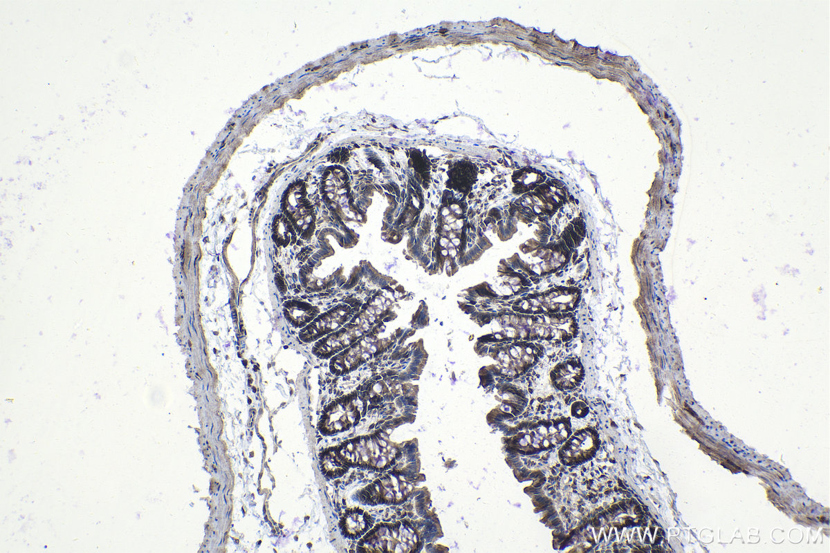 Immunohistochemical analysis of paraffin-embedded rat colon tissue slide using KHC1036 (STAT1 IHC Kit).