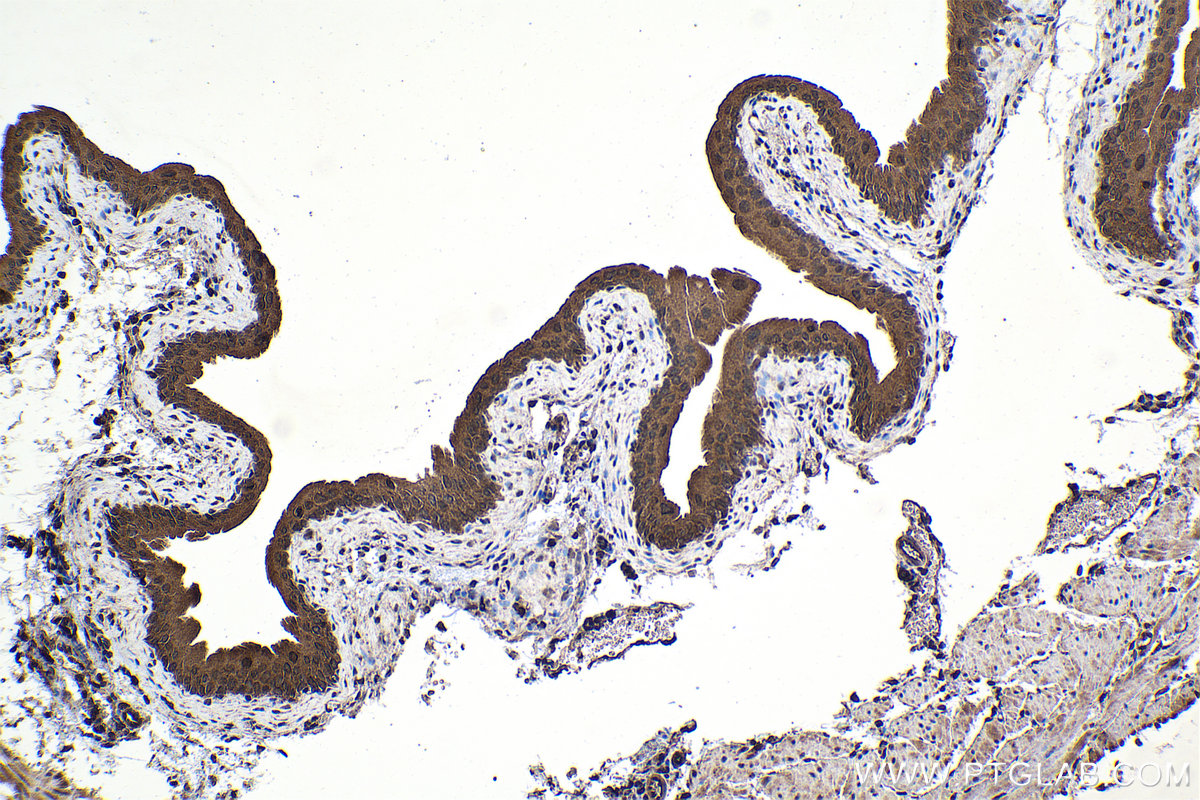 Immunohistochemical analysis of paraffin-embedded mouse bladder tissue slide using KHC1622 (STAT2 IHC Kit).