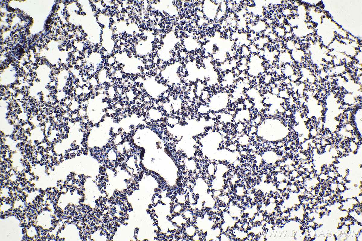 Immunohistochemical analysis of paraffin-embedded mouse lung tissue slide using KHC1622 (STAT2 IHC Kit).