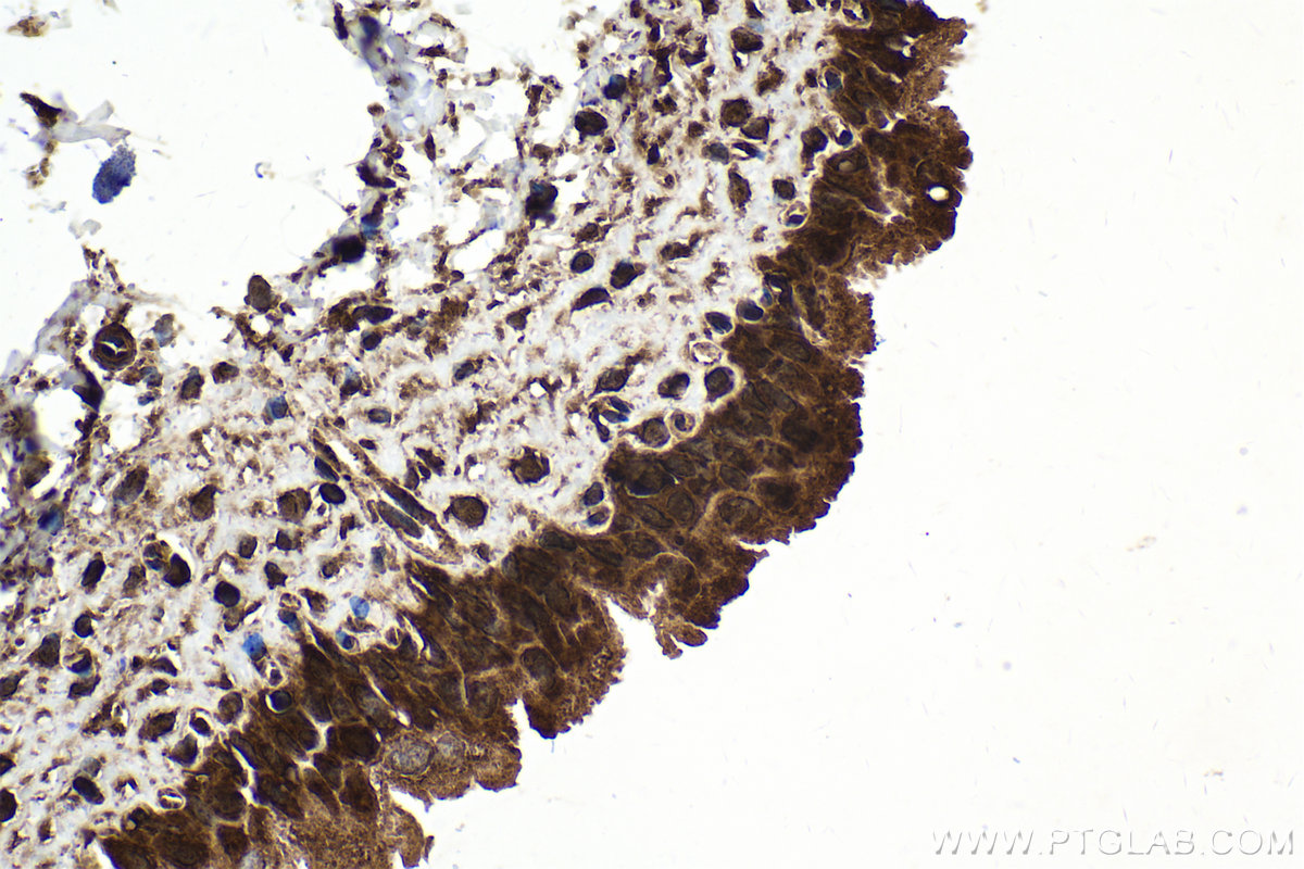 Immunohistochemical analysis of paraffin-embedded rat bladder tissue slide using KHC1622 (STAT2 IHC Kit).