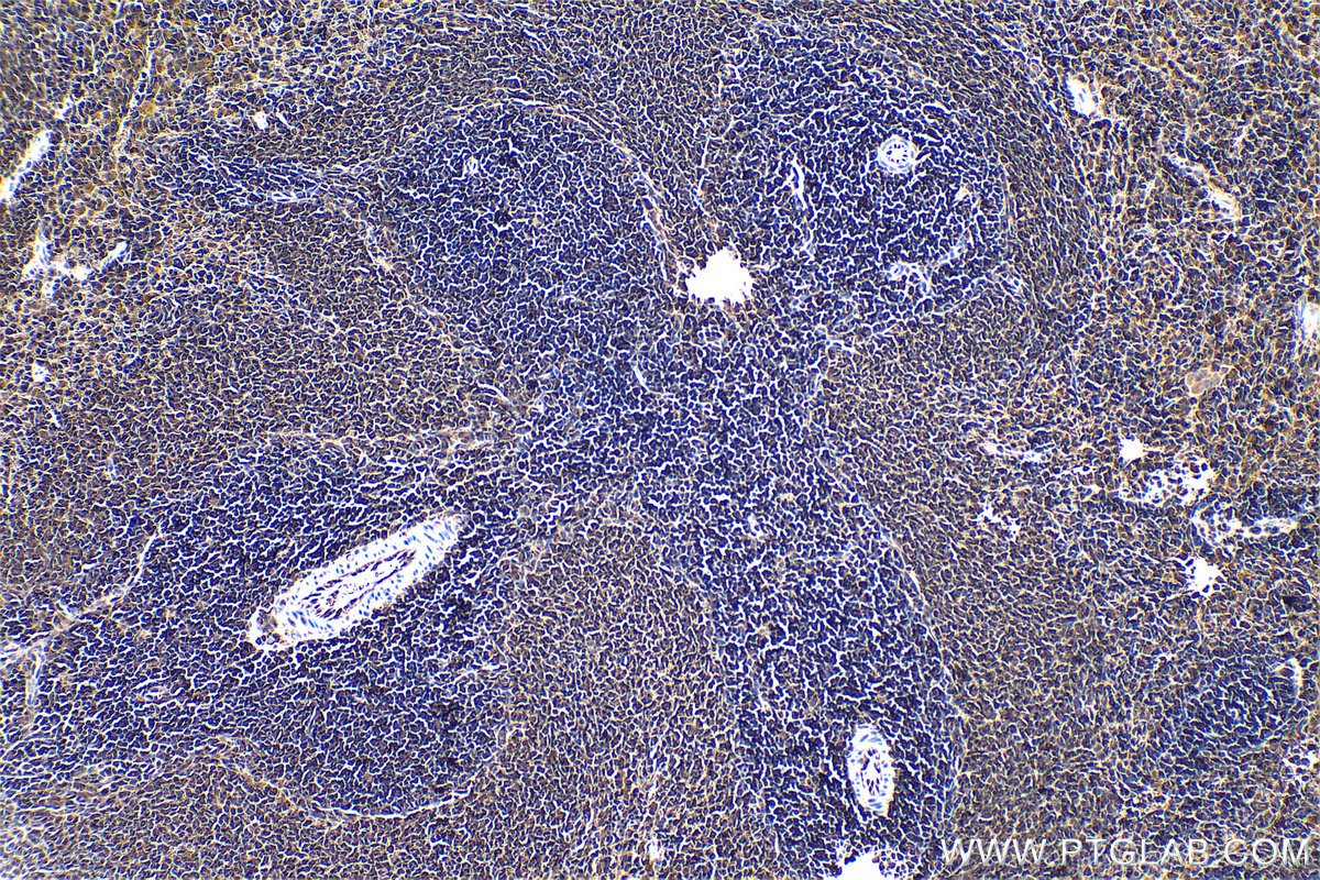 Immunohistochemical analysis of paraffin-embedded rat spleen tissue slide using KHC1622 (STAT2 IHC Kit).