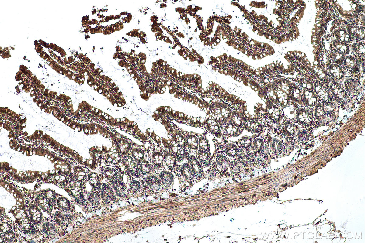 Immunohistochemical analysis of paraffin-embedded rat colon tissue slide using KHC0761 (STAT3 IHC Kit).