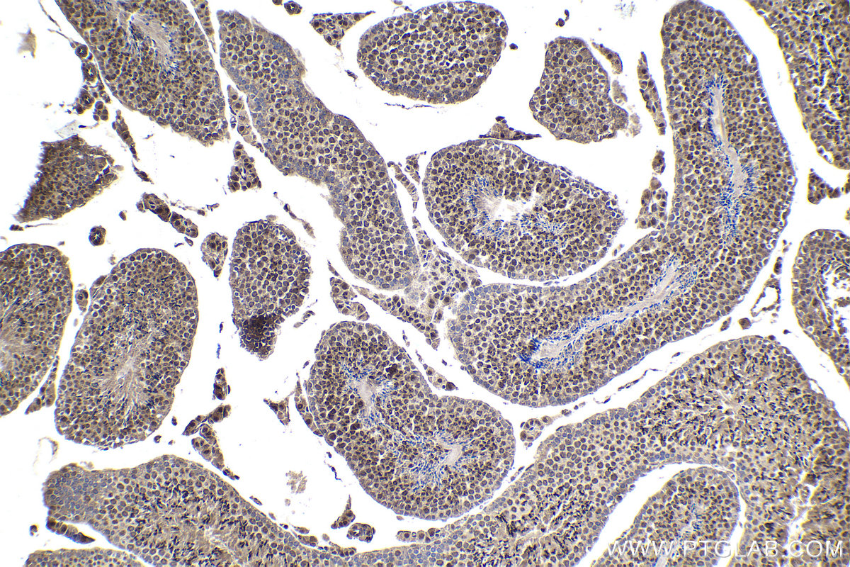 Immunohistochemical analysis of paraffin-embedded mouse testis tissue slide using KHC1736 (STAT4 IHC Kit).