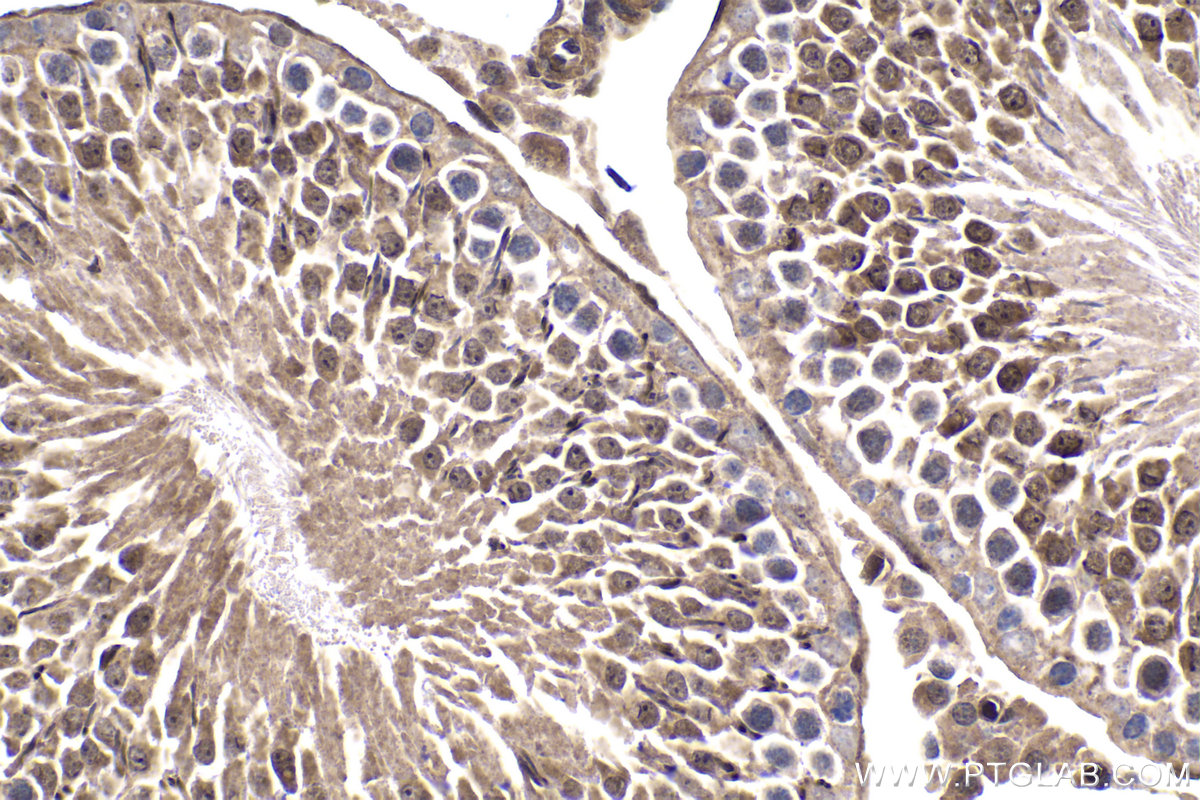 Immunohistochemical analysis of paraffin-embedded rat testis tissue slide using KHC1736 (STAT4 IHC Kit).