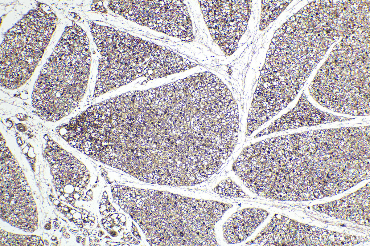 Immunohistochemical analysis of paraffin-embedded mouse brown adipose tissue slide using KHC1594 (STAT5A IHC Kit).