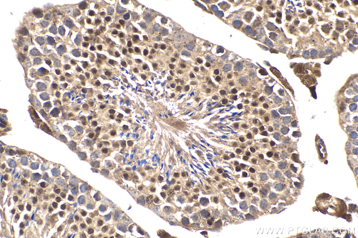 Immunohistochemical analysis of paraffin-embedded mouse testis tissue slide using KHC1594 (STAT5A IHC Kit).