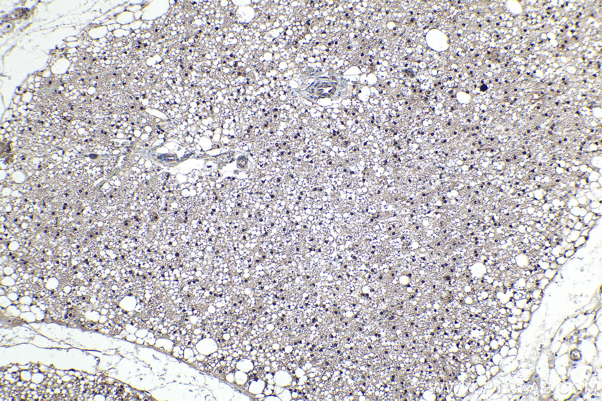 Immunohistochemical analysis of paraffin-embedded rat brown adipose tissue slide using KHC1594 (STAT5A IHC Kit).