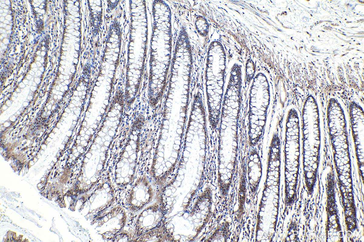 Immunohistochemical analysis of paraffin-embedded human colon tissue slide using KHC1151 (STAT6 IHC Kit).