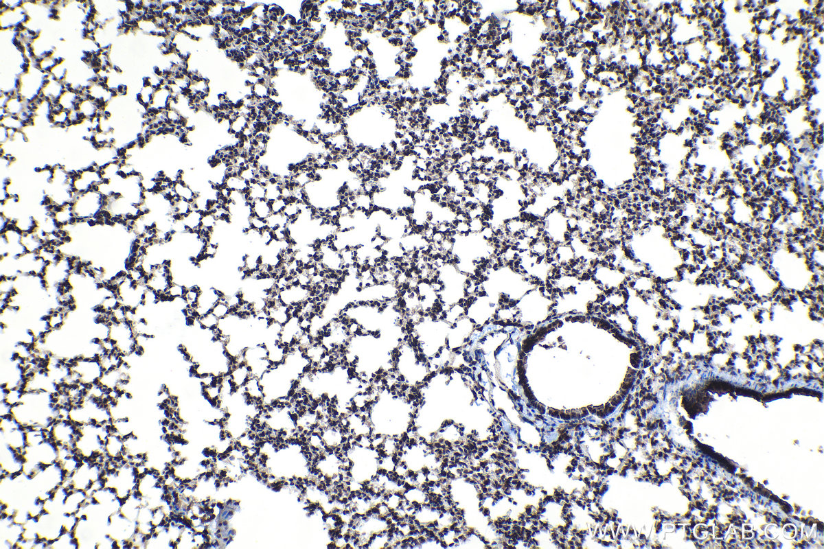 Immunohistochemical analysis of paraffin-embedded mouse lung tissue slide using KHC1151 (STAT6 IHC Kit).