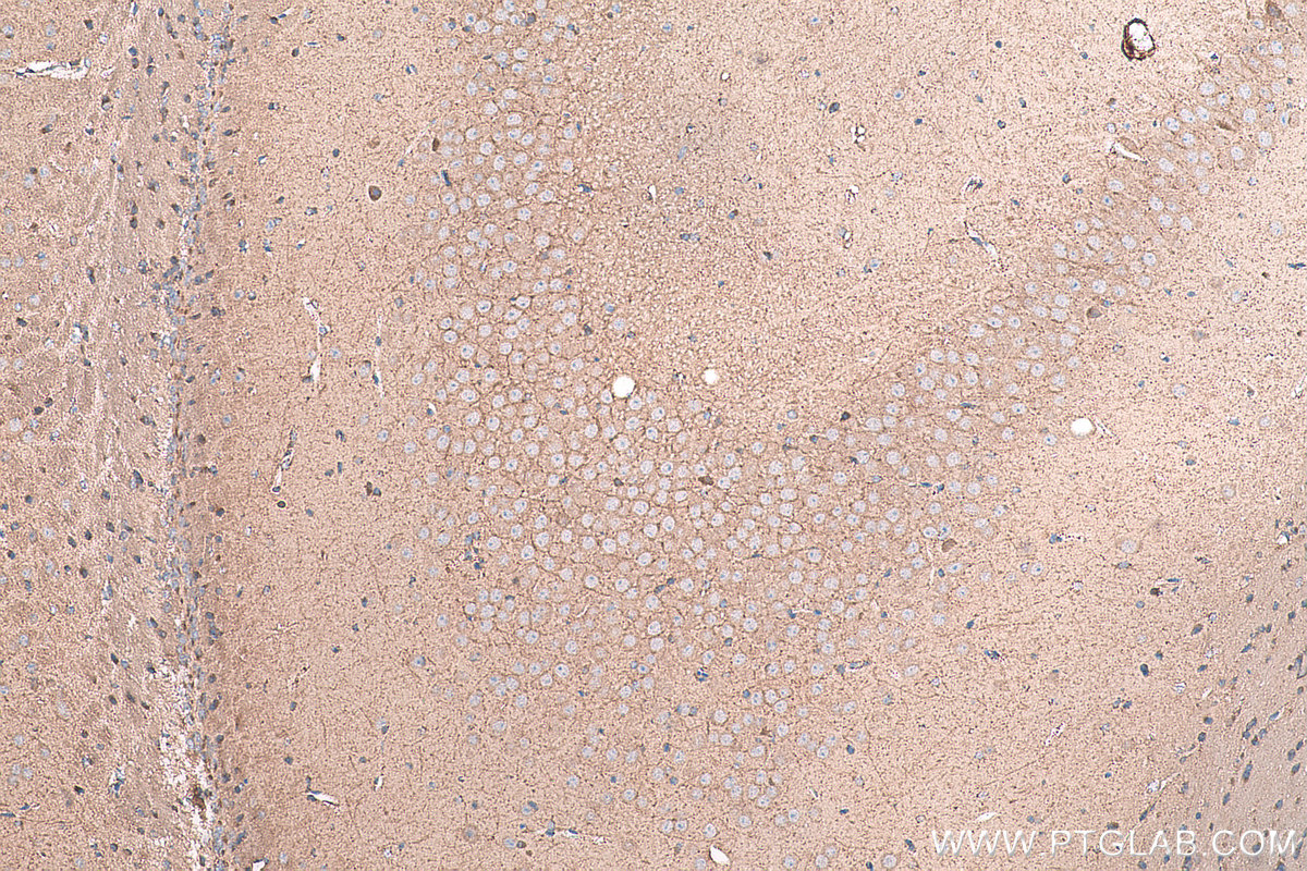 Immunohistochemical analysis of paraffin-embedded mouse brain tissue slide using KHC0985 (STAU1 IHC Kit).