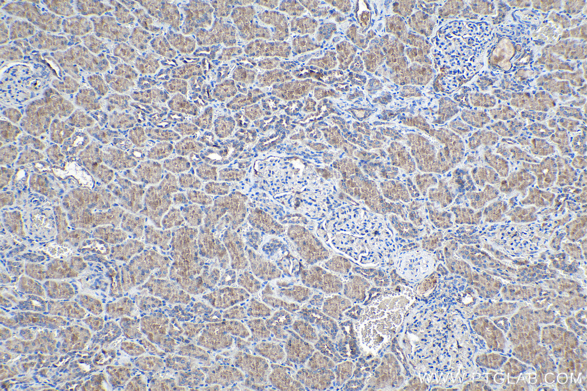 Immunohistochemical analysis of paraffin-embedded human kidney tissue slide using KHC0985 (STAU1 IHC Kit).