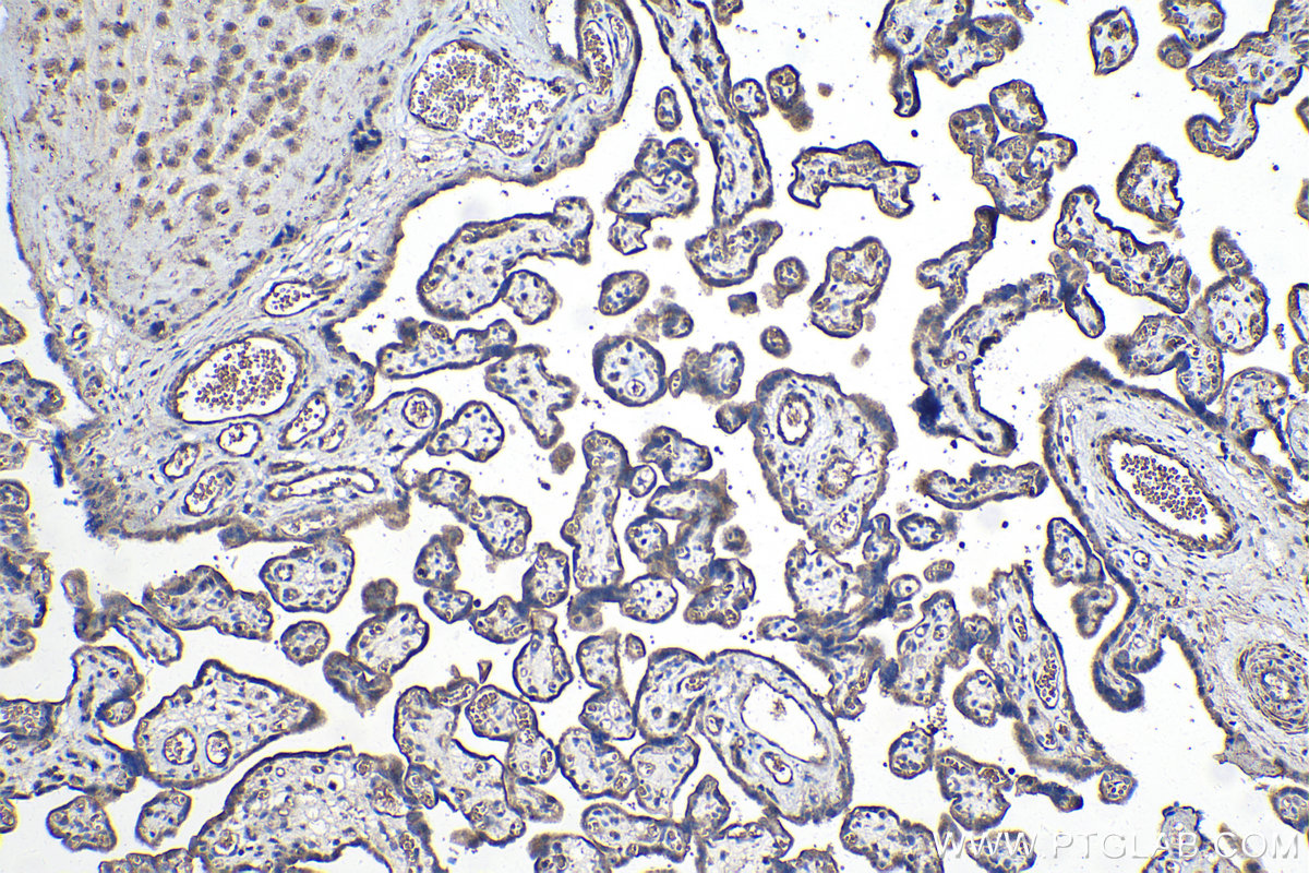 Immunohistochemical analysis of paraffin-embedded human placenta tissue slide using KHC0985 (STAU1 IHC Kit).