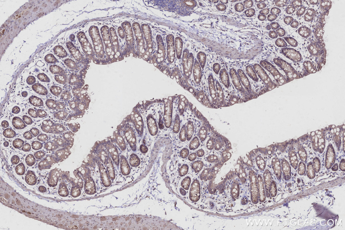 Immunohistochemical analysis of paraffin-embedded mouse colon tissue slide using KHC2955 (STAU2 IHC Kit).