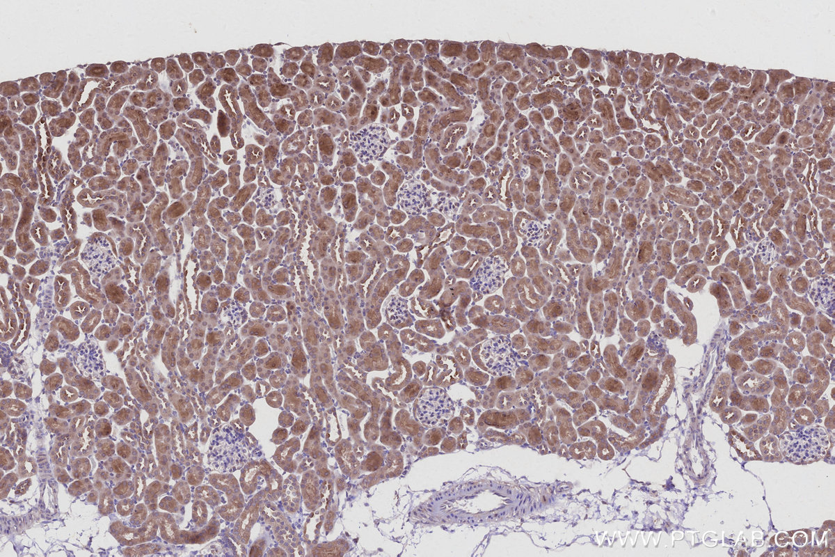 Immunohistochemical analysis of paraffin-embedded mouse kidney tissue slide using KHC2955 (STAU2 IHC Kit).
