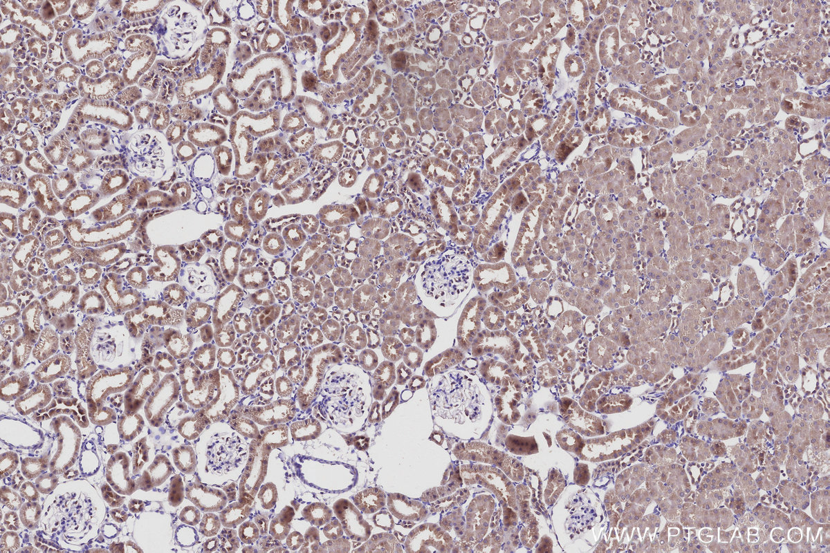 Immunohistochemical analysis of paraffin-embedded rat kidney tissue slide using KHC2955 (STAU2 IHC Kit).