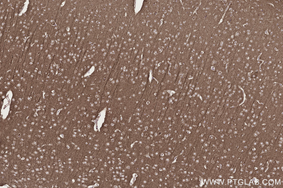Immunohistochemical analysis of paraffin-embedded rat brain tissue slide using KHC3300 (STEAP2 IHC Kit). Immunohistochemical analysis of paraffin-embedded rat brain tissue slide using KHC3300 (STEAP2 IHC Kit).