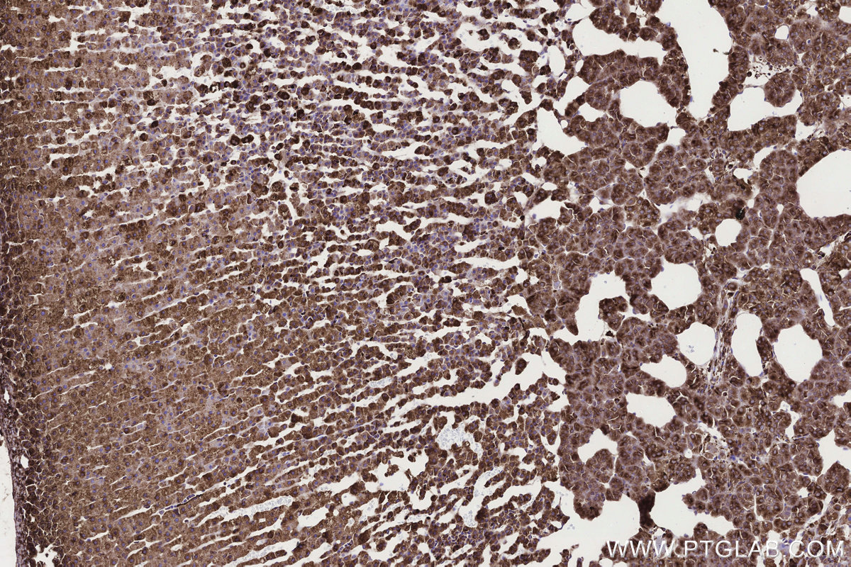 Immunohistochemical analysis of paraffin-embedded rat adrenal gland tissue slide using KHC3300 (STEAP2 IHC Kit). Immunohistochemical analysis of paraffin-embedded rat adrenal gland tissue slide using KHC3300 (STEAP2 IHC Kit).
