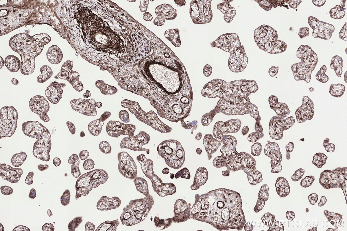Immunohistochemical analysis of paraffin-embedded human placenta tissue slide using KHC3300 (STEAP2 IHC Kit). Immunohistochemical analysis of paraffin-embedded human placenta tissue slide using KHC3300 (STEAP2 IHC Kit).