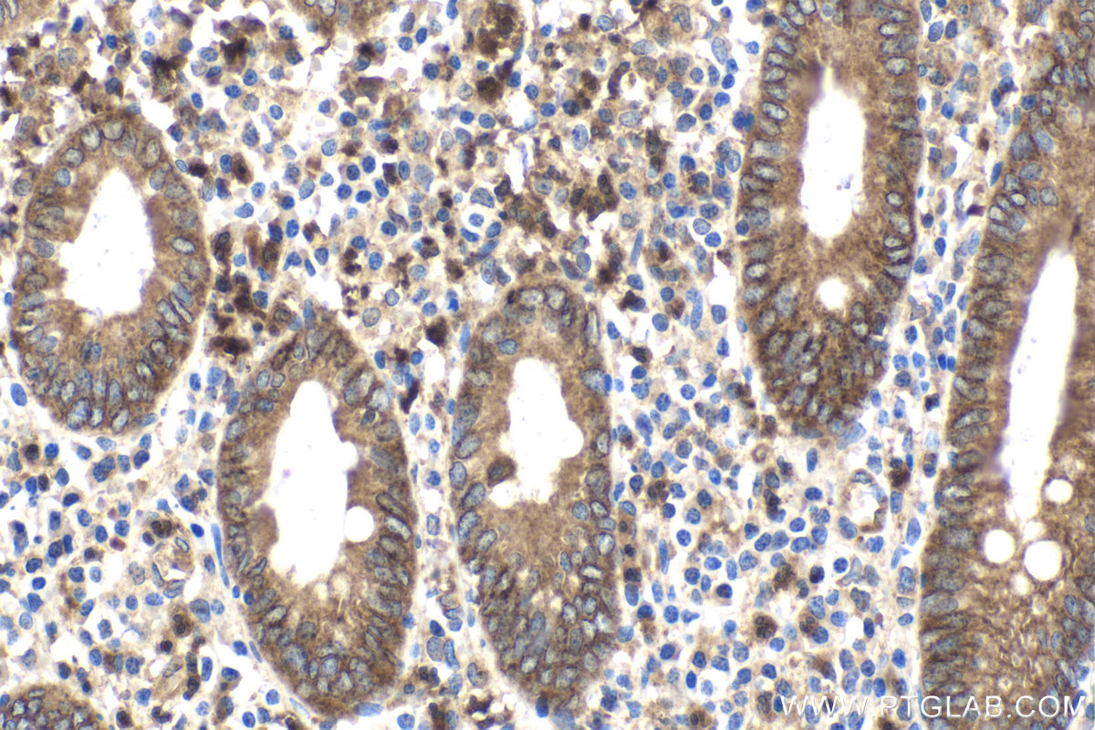 Immunohistochemical analysis of paraffin-embedded human appendicitis tissue slide using KHC1782 (STEAP3 IHC Kit).