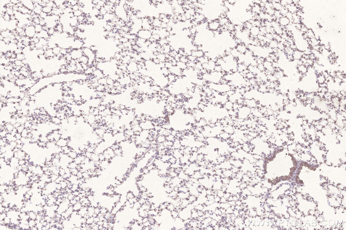 Immunohistochemical analysis of paraffin-embedded mouse lung tissue slide using KHC3267 (STEAP4 IHC Kit).