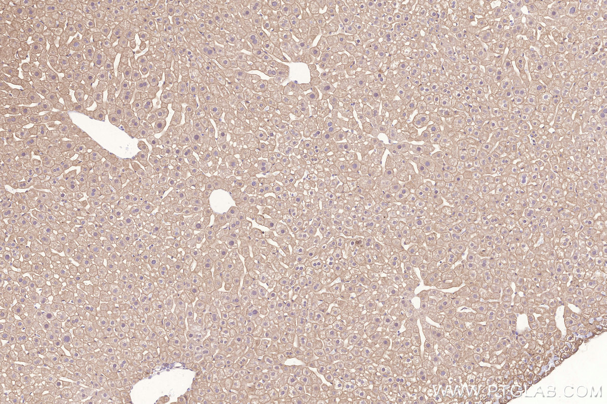 Immunohistochemical analysis of paraffin-embedded mouse liver tissue slide using KHC3267 (STEAP4 IHC Kit).