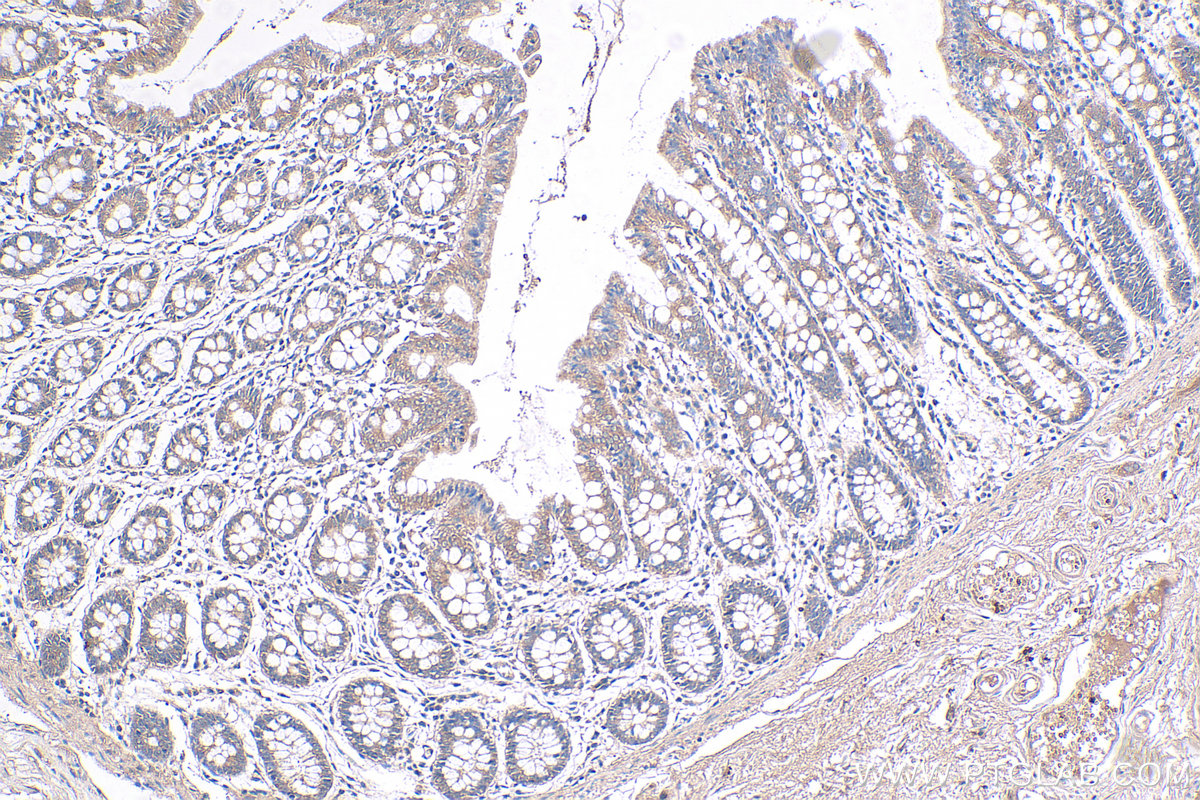 Immunohistochemical analysis of paraffin-embedded human colon tissue slide using KHC0278 (STK11 IHC Kit).