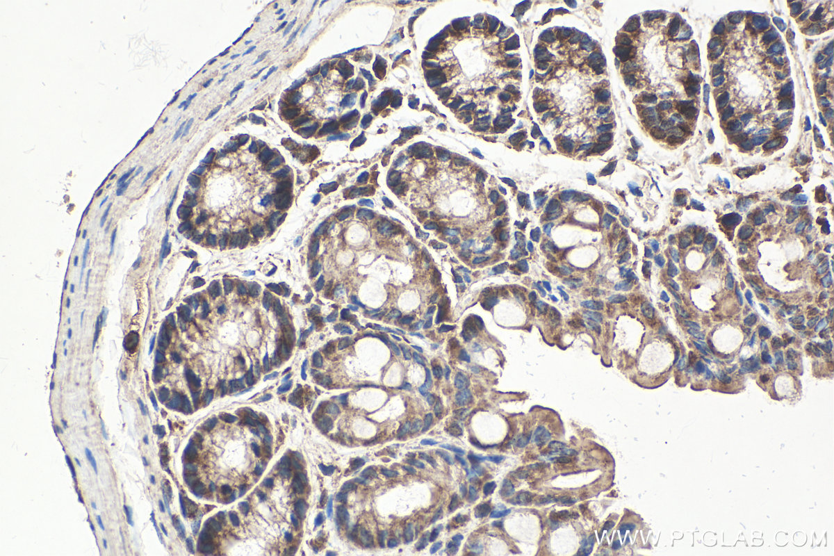 Immunohistochemical analysis of paraffin-embedded mouse colon tissue slide using KHC0278 (STK11 IHC Kit).