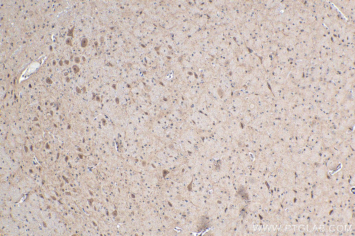 Immunohistochemical analysis of paraffin-embedded rat brain tissue slide using KHC0278 (STK11 IHC Kit).