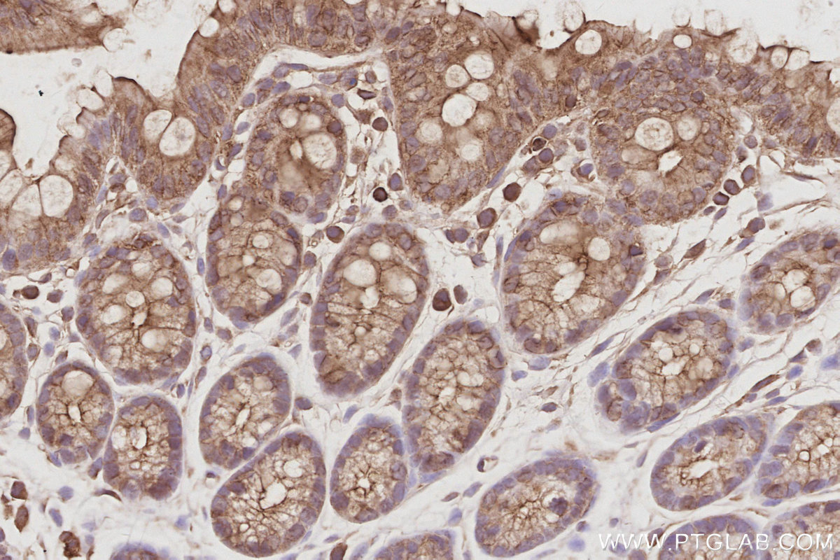 Immunohistochemical analysis of paraffin-embedded mouse colon tissue slide using KHC3090 (STK24 IHC Kit). Immunohistochemical analysis of paraffin-embedded mouse colon tissue slide using KHC3090 (STK24 IHC Kit).