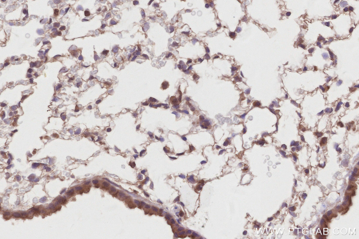 Immunohistochemical analysis of paraffin-embedded mouse lung tissue slide using KHC2888 (STK33 IHC Kit).