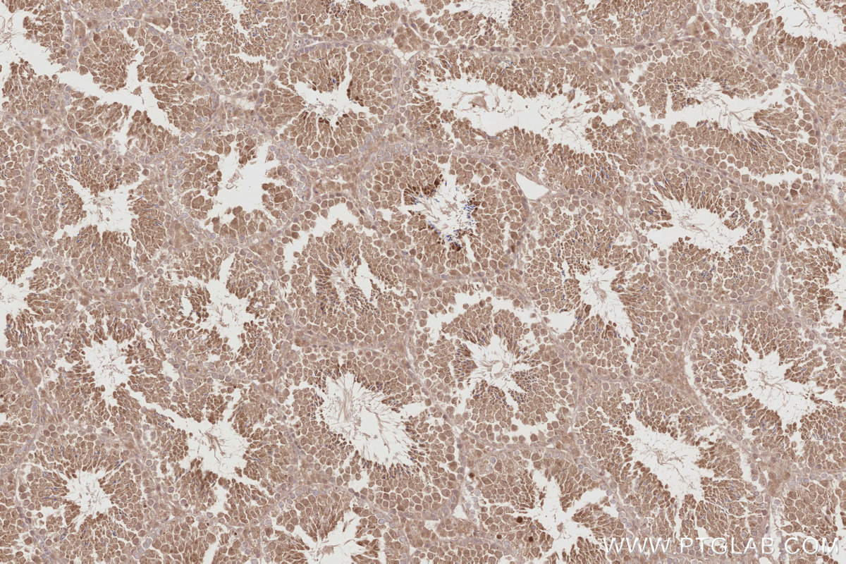 Immunohistochemical analysis of paraffin-embedded mouse testis tissue slide using KHC2888 (STK33 IHC Kit).