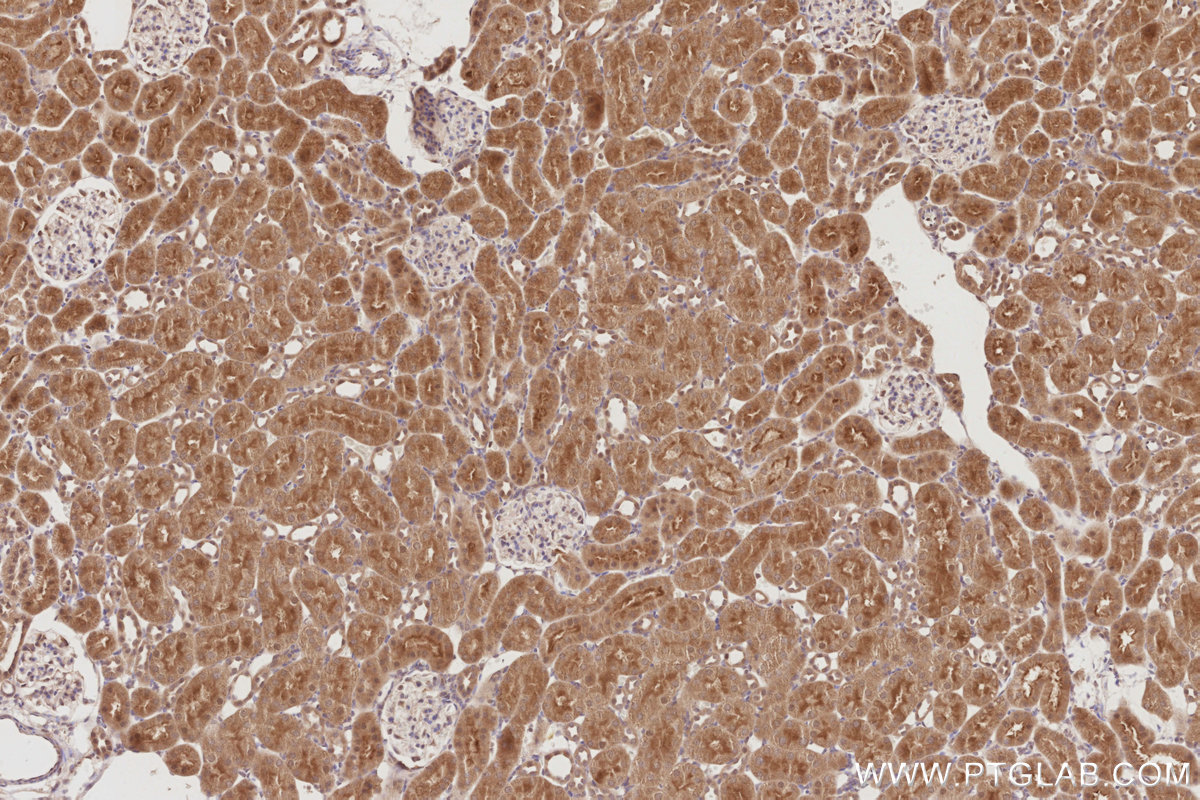 Immunohistochemical analysis of paraffin-embedded rat kidney tissue slide using KHC2888 (STK33 IHC Kit).
