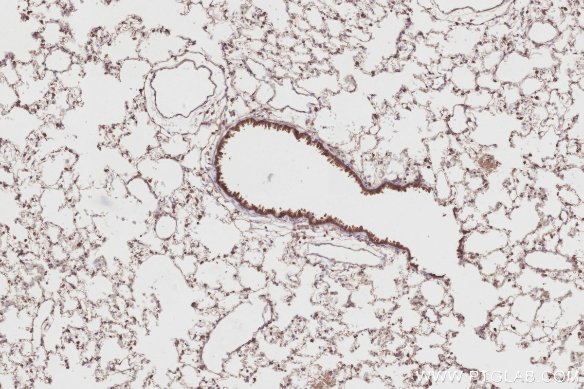 Immunohistochemical analysis of paraffin-embedded rat lung tissue slide using KHC2888 (STK33 IHC Kit).