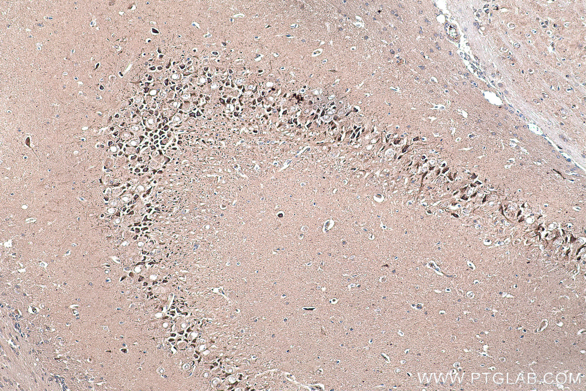 Immunohistochemical analysis of paraffin-embedded rat brain tissue slide using KHC0300 (STMN2 IHC Kit).