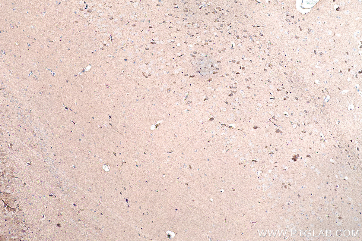 Immunohistochemical analysis of paraffin-embedded mouse brain tissue slide using KHC0300 (STMN2 IHC Kit).