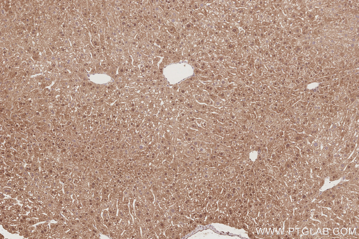 Immunohistochemical analysis of paraffin-embedded mouse liver tissue slide using KHC2895 (STRADB IHC Kit).